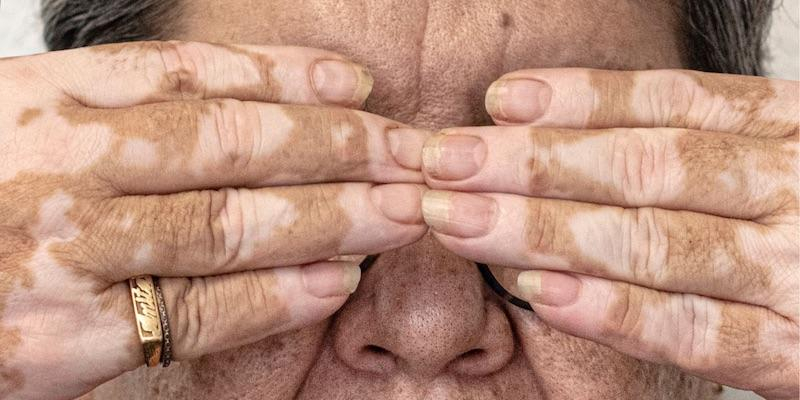 El Centro Residencial S&iacute;nodo 2005 de C&aacute;ritas Diocesana de Madrid acoge la exposici&oacute;n de fotograf&iacute;a '(In)Visibles'