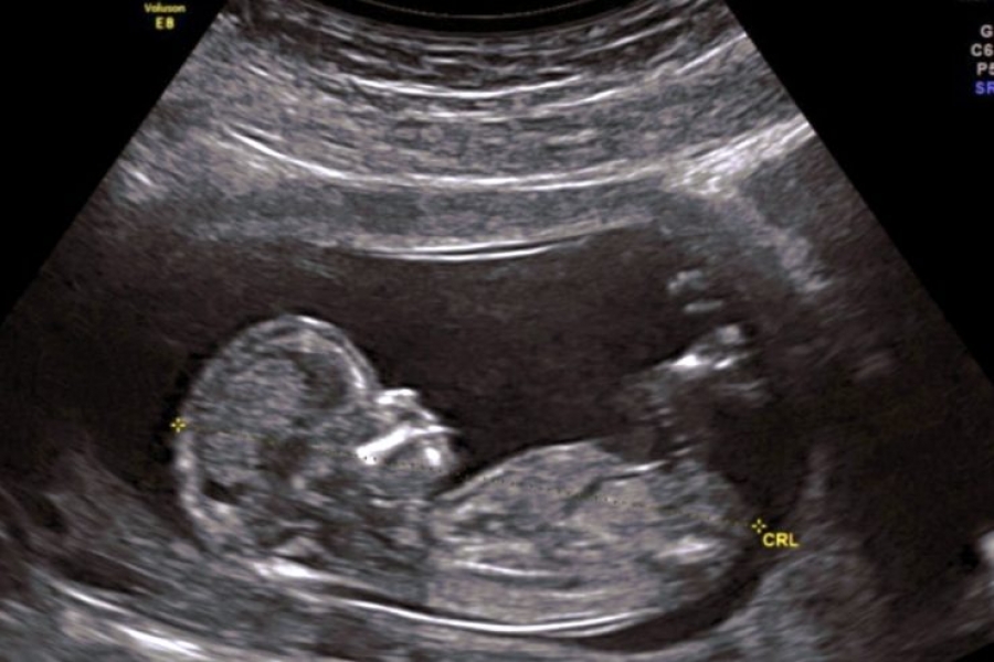 Pastoral Familiar de Bolivia: &laquo;Las leyes deben servir y proteger, no matar y dividir&raquo;