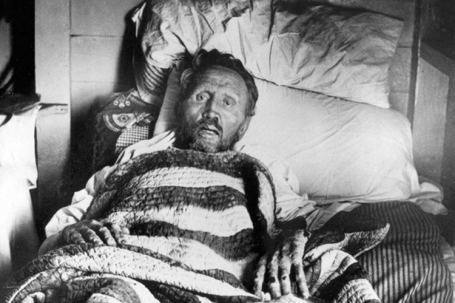 La Iglesia atiende 611 leproser&iacute;as en todo el mundo