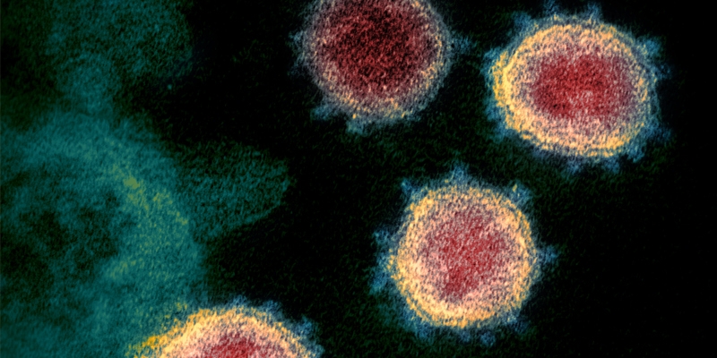SARS-CoV-2 también conocido como 2019-nCoV, el virus que causa el COVID-19